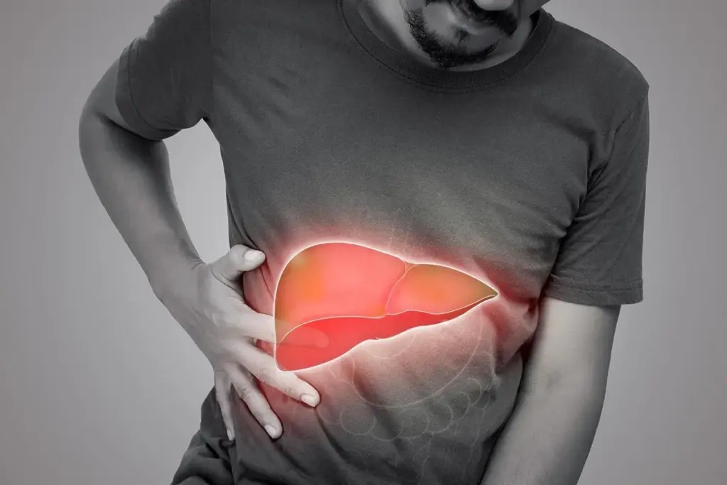 Silent Epidemic of Liver Disease in Pakistan